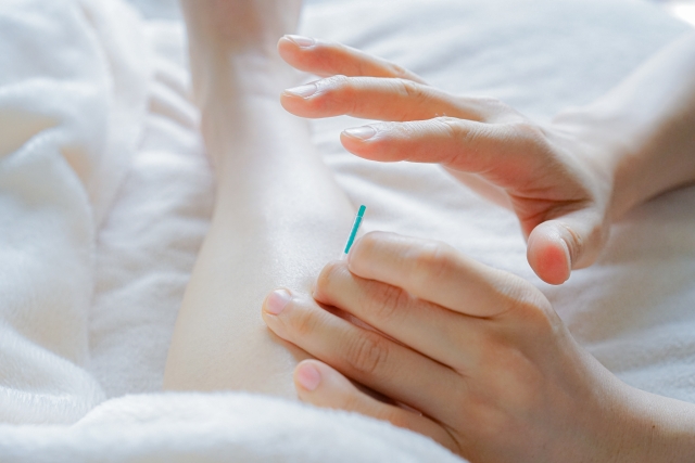 大阪市三津屋の女性専用鍼灸院の施術風景