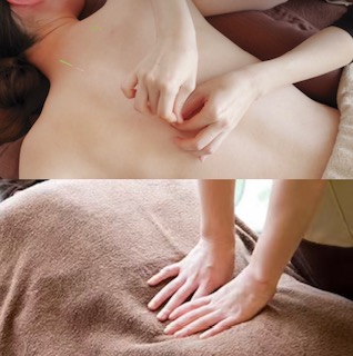 大阪市三津屋の女性専用鍼灸院での鍼灸治療風景