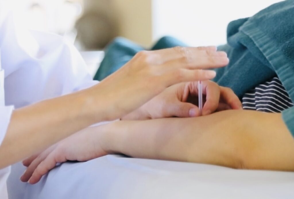 大阪市淀川区の女性専用鍼灸院での鍼灸治療風景。